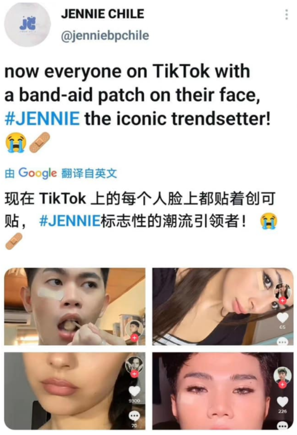 Bị thương cũng tạo trend: Netizen rần rần trào lưu dán băng cá nhân lên mặt như Jennie (BLACKPINK) Ảnh 2