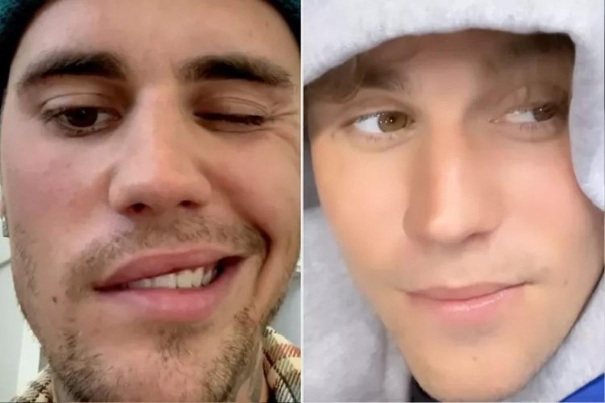 Tình trạng sức khỏe của Justin Bieber sau 10 tháng được chẩn đoán mắc bệnh liệt cơ mặt Ảnh 2