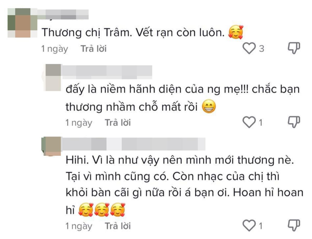 Hát live 'Về với em', netizen chỉ ra chi tiết lạ trên bụng Võ Hạ Trâm, sự thật khiến nhiều người đồng cảm Ảnh 6