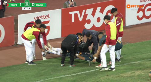 Mặt sân Mỹ Đình khiến tuyển thủ ĐT Việt Nam chấn thương nặng 2 Ngao ngán mặt sân xấu trong ngày Lý Đức của HAGL chấn thương - Saostar.vn