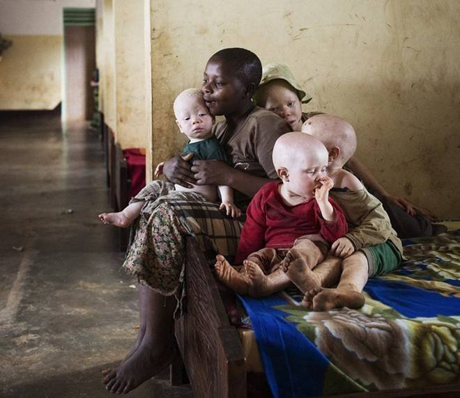 Cuộc sống thấp thỏm của những 'thần bất tử' ở châu Phi Ảnh 2