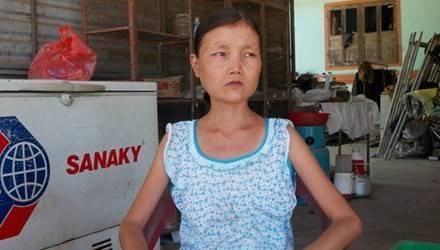 Cô gái mỗi bữa ăn 6 lon gạo, uống 15 lít nước một ngày Ảnh 2