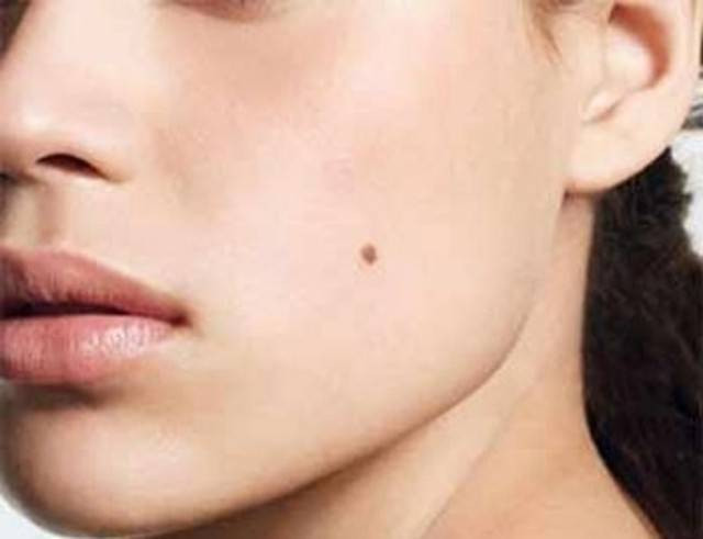 Vị trí nốt ruồi báo hiệu số phận cô độc Ảnh 2