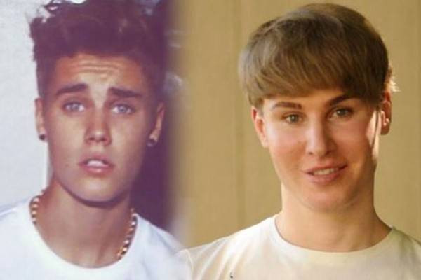 Fan cuồng phẫu thuật giống Justin Bieber đã qua đời Ảnh 2
