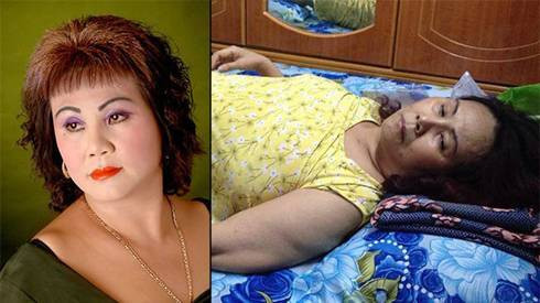 Nghệ sĩ Hoàng Lan có khả năng sẽ bị mù 2 mắt Ảnh 2