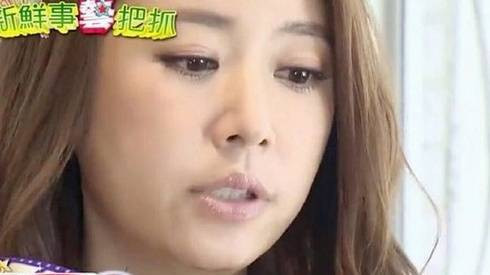 Lâm Tâm Như lộ sẹo sau tai nạn, nghi vấn thẩm mỹ Ảnh 2