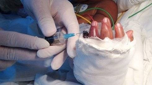 Bé 2 tuổi theo mẹ đi làm bị xích máy cắt gạch cắt lìa bàn tay Ảnh 2