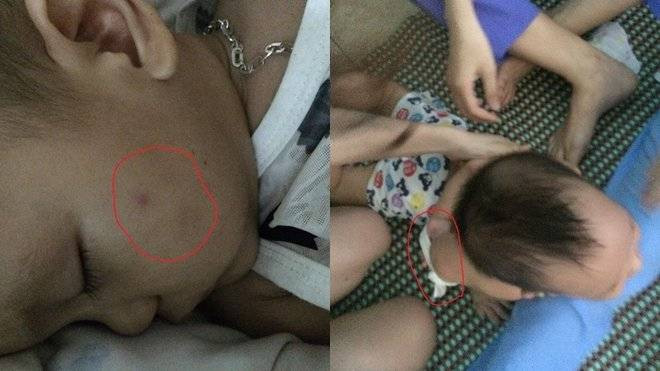 Bé 15 tháng bị 3 giáo viên trói chặt, hành hung và nhét giẻ vào miệng Ảnh 2