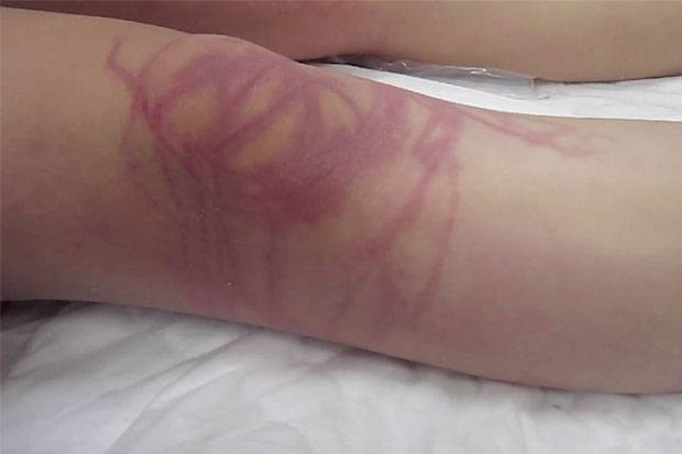 Bị sứa cắn khi đang tắm biển, một du khách Đức tử vong ở Thái Ảnh 2