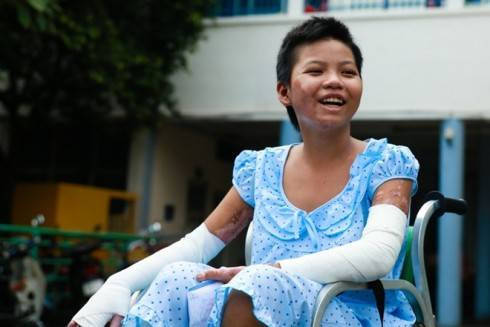 Nụ cười ngày ra viện của cô bé bán vé số bị mẹ đốt Ảnh 2