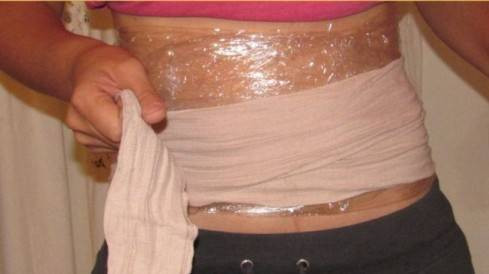 Quấn nilon đốt mỡ có tác dụng đến đâu? Ảnh 2