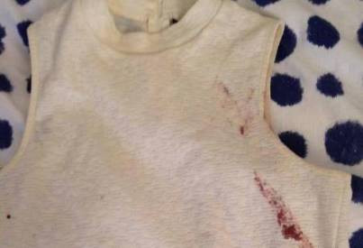 Ám ảnh kinh hoàng của cô gái giả chết để thoát khỏi bọn khủng bố Paris Ảnh 2