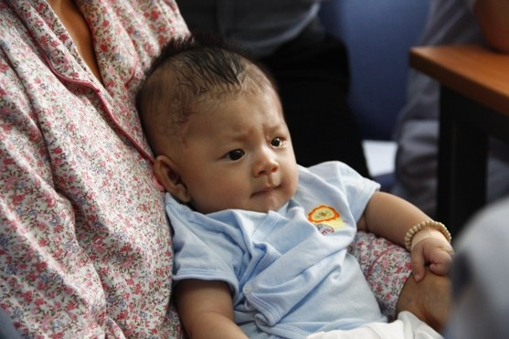 Bé trai bị đâm xuyên sọ bất ngờ nhập viện vì viêm màng não mủ Ảnh 2