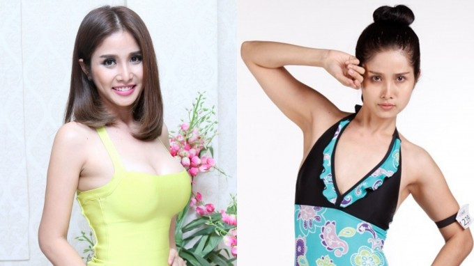 Thảo Trang - vợ cầu thủ Phan Thanh Bình công khai phẫu thuật nâng ngực Ảnh 2