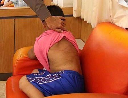 Phẫn nộ với sự thật bức ảnh về em bé bị dì ghẻ hành hạ vì ăn cắp vặt Ảnh 2