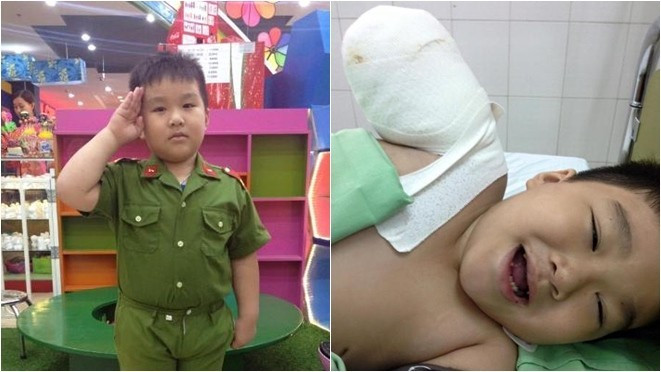 Cảm phục trước nghị lực của cậu bé 6 tuổi bị đứt lìa cánh tay Ảnh 2