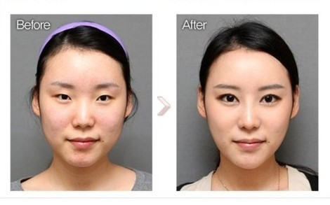 Học sinh Hàn Quốc quyết tâm đỗ đại học để được… cắt mí mắt Ảnh 2