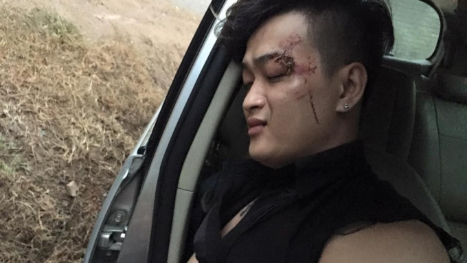 Nhóm HKT gặp tai nạn nghiêm trọng trên đường đèo Sơn La Ảnh 2