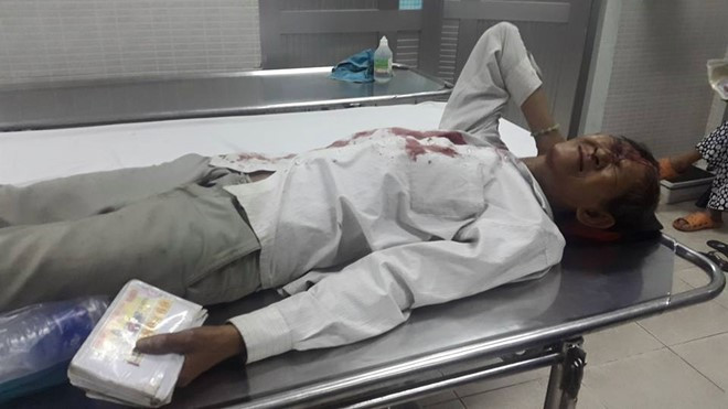 Sốc trước sự thật về ông lão bán vé số bị đánh nằm bất tỉnh ven đường Ảnh 2