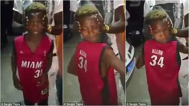 Kỳ lạ cậu bé có khả năng quay ngược đầu 180 độ Ảnh 2