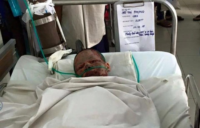 Dân mạng xót thương cô gái bị bạn trai tưới xăng thiêu sống Ảnh 2