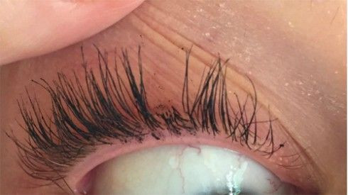 9 tai nạn làm đẹp đáng sợ và ồn ào nhất năm 2015 Ảnh 2