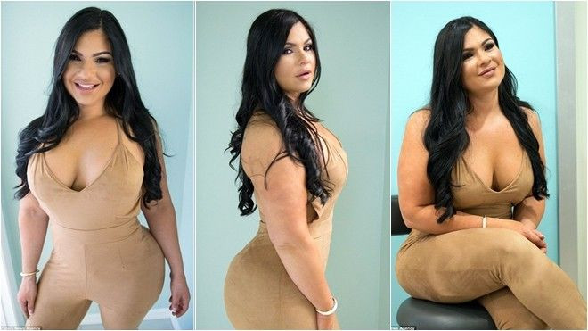 Nữ y tá tiêm gần 2kg mỡ vào mông để được như ‘cô Kim siêu vòng 3’ Ảnh 2