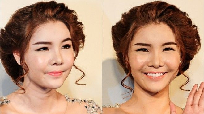 Sốc với gương mặt sưng tấy và già nua của Kỳ Hân Ảnh 2