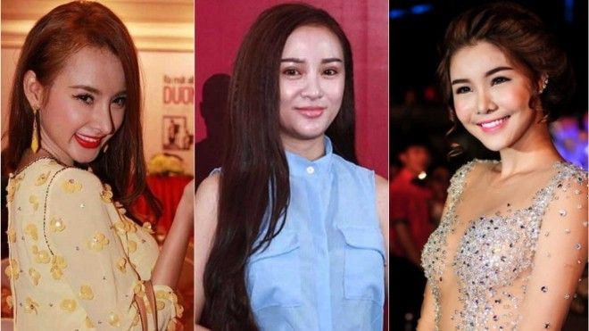 Sao Việt dính nghi án vừa ‘dao kéo’ xong đã liều lĩnh tham dự sự kiện Ảnh 2