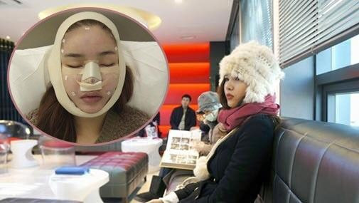 Hot: Lộ loạt ảnh dao kéo lần thứ 4 của Kỳ Hân Ảnh 2