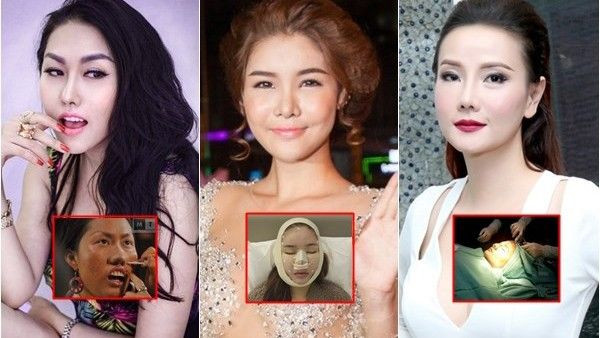 3 mỹ nhân Việt không phủ nhận phẫu thuật thẩm mỹ Ảnh 2