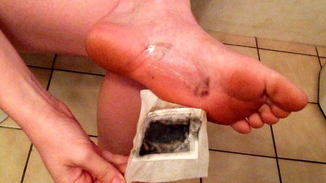 Kinoki foot pad - miếng thải độc tố hay sản phẩm gây hại cơ thể? Ảnh 2