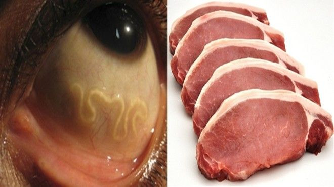 Chính món ăn khoái khẩu này đã khiến cô gái trẻ phải nhập viện Ảnh 2