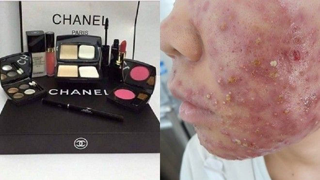 1001 chiêu lừa đảo tinh vi trên các group làm đẹp Ảnh 2