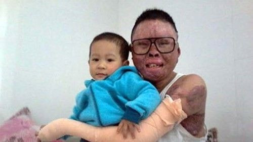 Cảm phục tinh thần của chiến sĩ duy nhất sống sót trong vụ máy bay rơi ở Hòa Lạc Ảnh 2