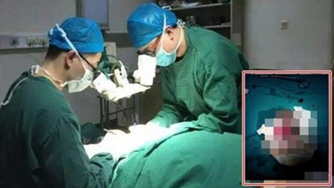 Tự cắt phăng 'của quý' vì không chịu nổi áp lực dư luận Ảnh 2