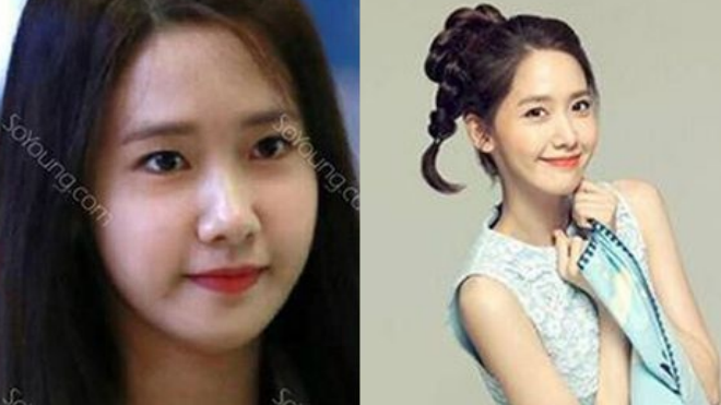 Bằng chứng dao kéo của 'Thất đại mỹ nhân' đẹp tự nhiên xứ Hàn Ảnh 2