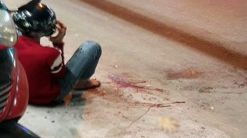 Nam thanh niên bị truy sát, chém đứt tay ở Gò Vấp Ảnh 2