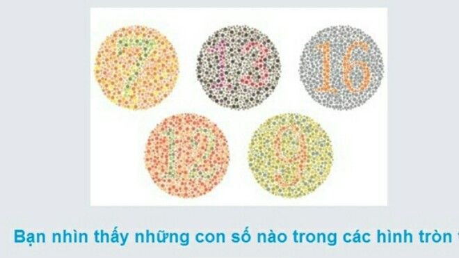 Bài kiểm tra thị giác 'hại não' chỉ có phi công mới vượt qua nổi Ảnh 2