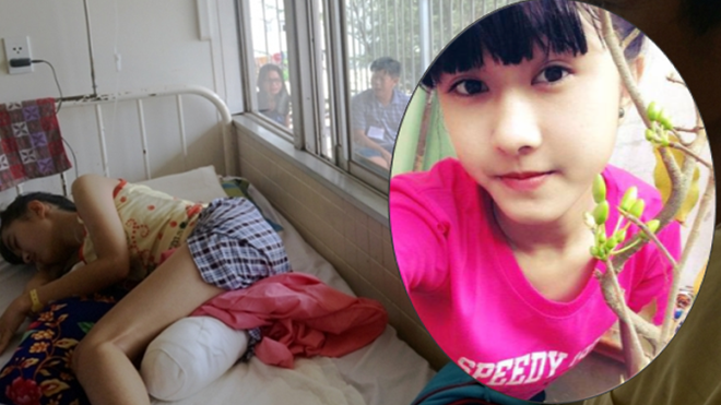 Vụ nữ sinh lớp 10 bị cưa chân: Ai phải chịu trách nhiệm cho tội ác này? Ảnh 2