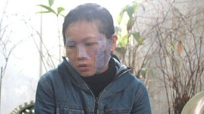 Chồng dí bát sắt nung đỏ vào mặt vợ vì tội tham gia bán hàng đa cấp Ảnh 2