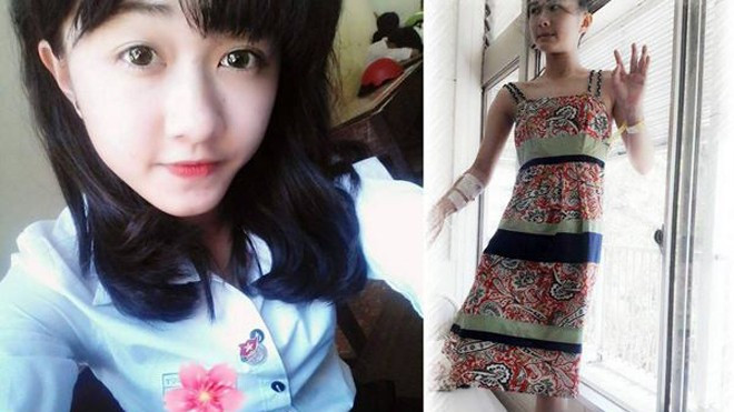 Gia đình nữ sinh bị cưa chân đòi bồi thường 1 tỷ đồng Ảnh 2