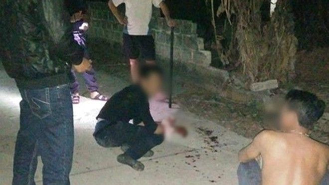 Trộm chó giữa đêm, nam thanh niên bị chém nát hai bàn tay Ảnh 2