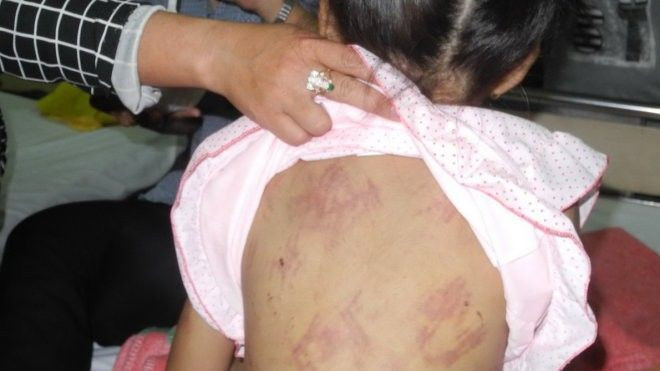 Khởi tố mẹ kế hành hung dã man bé 8 tuổi Ảnh 2