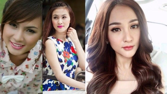 Kelly chấp nhận mất gần 200 triệu để sang Hàn phẫu thuật lại cằm lần thứ 6 Ảnh 2