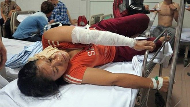 Nổ lớn tại công ty gỗ, 11 người bỏng nặng Ảnh 2