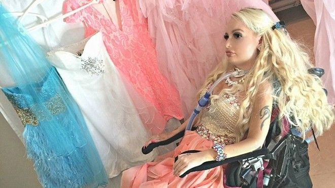 Cô gái liệt tứ chi sẵn sàng chi hàng trăm triệu để được giống thần tượng Ảnh 2