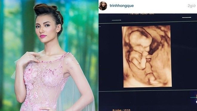 Hồng Quế bất ngờ công khai thông tin đang mang thai Ảnh 2