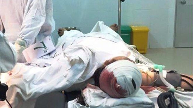 Nghi vấn ghen tuông, chồng chém vợ thập tử nhất sinh Ảnh 2