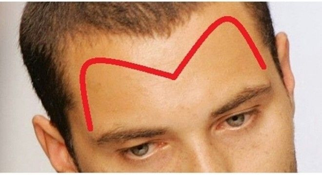 Vì sao người có trán hình chữ M sẽ là nghệ sỹ bậc thầy? Ảnh 2
